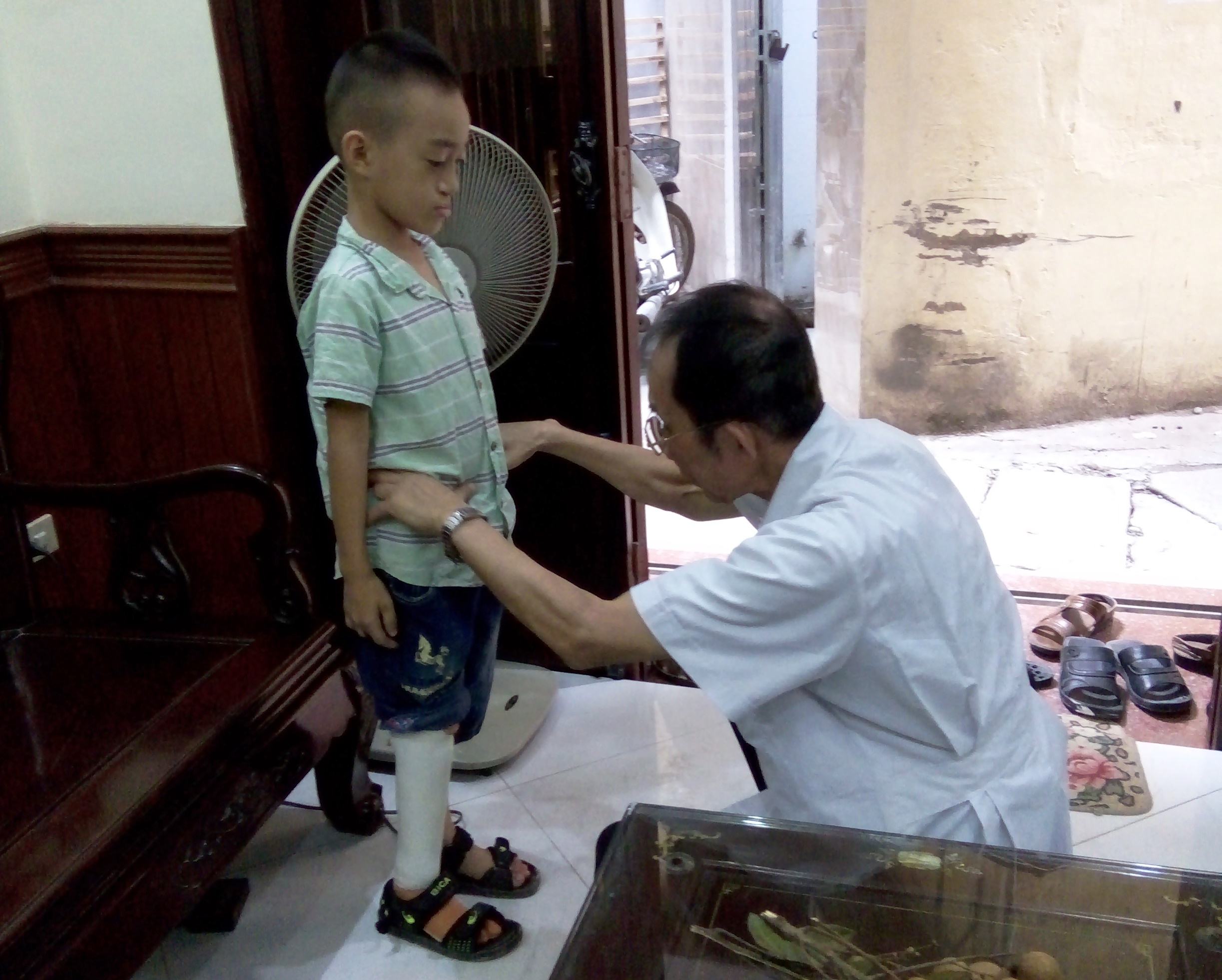 Bác sỹ Lê Thành Đô lắp chân giả miễn phí cho trẻ em nghèo. (Ảnh: PV/Vietnam+)